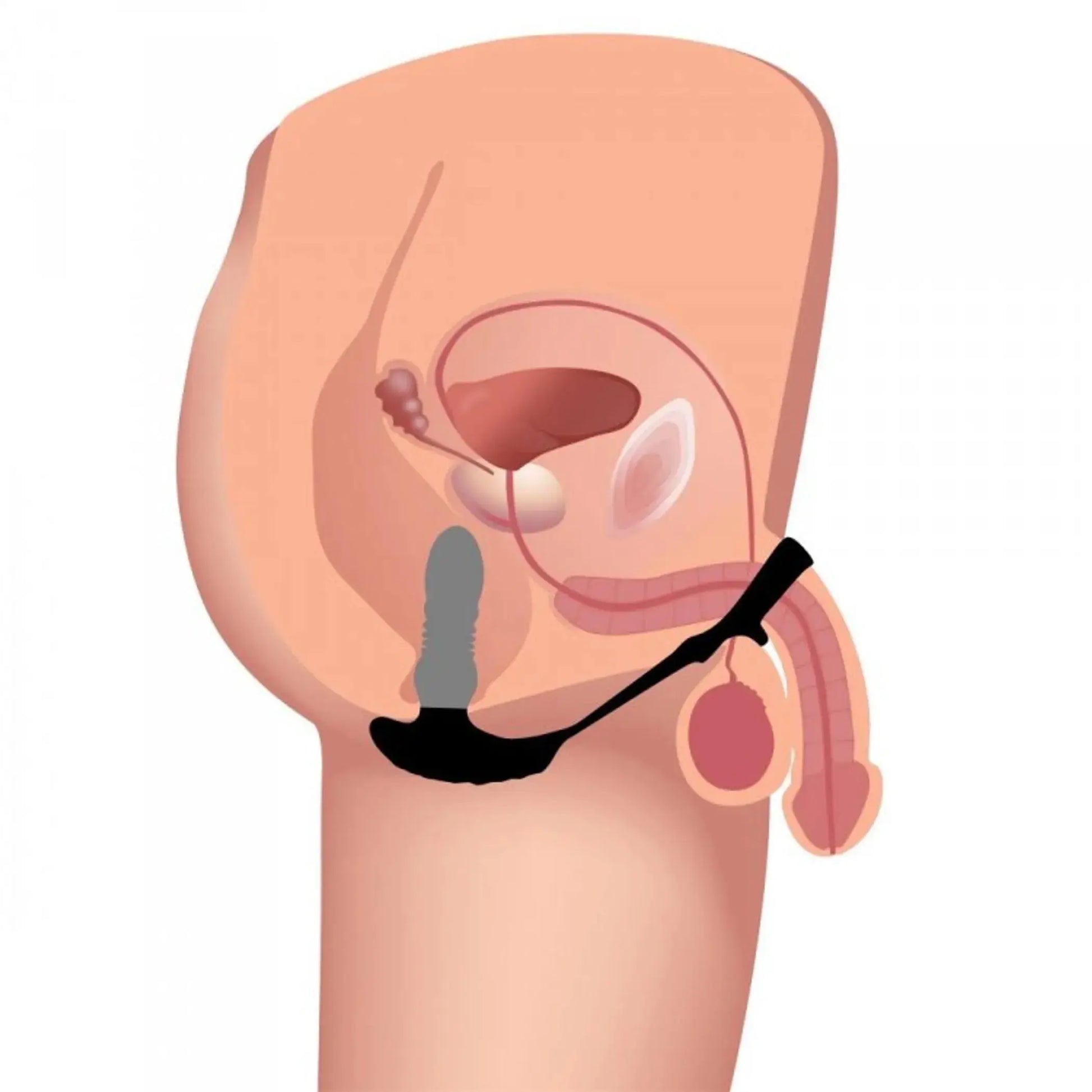 Thunderplugs 10X Thrusting Plug with Cock and Ball Ring XR Brands